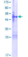 FAM125B Protein - 12.5% SDS-PAGE of human FAM125B stained with Coomassie Blue