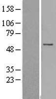 FAM126A / HCC Protein - Western validation with an anti-DDK antibody * L: Control HEK293 lysate R: Over-expression lysate