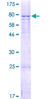 FAM126A / HCC Protein - 12.5% SDS-PAGE of human FAM126A stained with Coomassie Blue