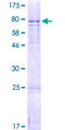 FAM126A / HCC Protein - 12.5% SDS-PAGE of human FAM126A stained with Coomassie Blue