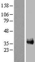 FAM133A Protein - Western validation with an anti-DDK antibody * L: Control HEK293 lysate R: Over-expression lysate