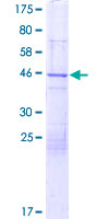 FAM13A1 / KIAA0914 Protein - 12.5% SDS-PAGE of human FAM13A1 stained with Coomassie Blue