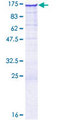 FAM13B Protein - 12.5% SDS-PAGE of human C5orf5 stained with Coomassie Blue