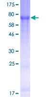 FAM149B1 Protein - 12.5% SDS-PAGE of human FAM149B1 stained with Coomassie Blue