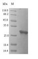 FAM150A Protein - (Tris-Glycine gel) Discontinuous SDS-PAGE (reduced) with 5% enrichment gel and 15% separation gel.