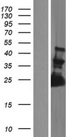 FAM156A / TMEM29 Protein - Western validation with an anti-DDK antibody * L: Control HEK293 lysate R: Over-expression lysate