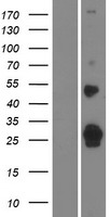 FAM159A Protein - Western validation with an anti-DDK antibody * L: Control HEK293 lysate R: Over-expression lysate