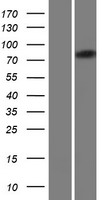 FAM160B2 / RAI16 Protein - Western validation with an anti-DDK antibody * L: Control HEK293 lysate R: Over-expression lysate
