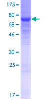 FAM160B2 / RAI16 Protein - 12.5% SDS-PAGE of human RAI16 stained with Coomassie Blue