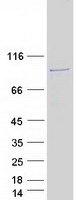 FAM160B2 / RAI16 Protein - Purified recombinant protein FAM160B2 was analyzed by SDS-PAGE gel and Coomassie Blue Staining