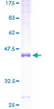 FAM162A / C3orf28 Protein - 12.5% SDS-PAGE of human E2IG5 stained with Coomassie Blue