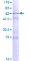 FAM164A / CGI-62 Protein - 12.5% SDS-PAGE of human C8orf70 stained with Coomassie Blue