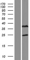 FAM166B Protein - Western validation with an anti-DDK antibody * L: Control HEK293 lysate R: Over-expression lysate
