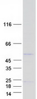 FAM167B Protein - Purified recombinant protein FAM167B was analyzed by SDS-PAGE gel and Coomassie Blue Staining