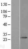 FAM168A Protein - Western validation with an anti-DDK antibody * L: Control HEK293 lysate R: Over-expression lysate