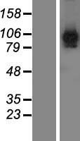 FAM171B Protein - Western validation with an anti-DDK antibody * L: Control HEK293 lysate R: Over-expression lysate
