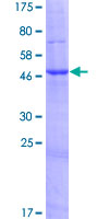 FAM173B Protein - 12.5% SDS-PAGE of human LOC134145 stained with Coomassie Blue