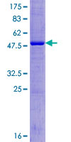 FAM174A Protein - 12.5% SDS-PAGE of human UNQ1912 stained with Coomassie Blue
