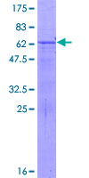 FAM177A1 Protein - 12.5% SDS-PAGE of human C14orf24 stained with Coomassie Blue