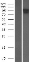FAM179A Protein - Western validation with an anti-DDK antibody * L: Control HEK293 lysate R: Over-expression lysate