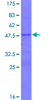 FAM180A Protein - 12.5% SDS-PAGE of human UNQ1940 stained with Coomassie Blue
