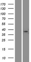 FAM181A Protein - Western validation with an anti-DDK antibody * L: Control HEK293 lysate R: Over-expression lysate