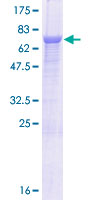 FAM188A / C10orf97 Protein - 12.5% SDS-PAGE of human C10orf97 stained with Coomassie Blue