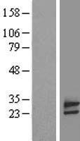 FAM18B Protein - Western validation with an anti-DDK antibody * L: Control HEK293 lysate R: Over-expression lysate