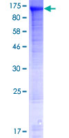 FAM190A Protein - 12.5% SDS-PAGE of human MGC48628 stained with Coomassie Blue