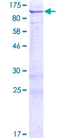 FAM190B Protein - 12.5% SDS-PAGE of human KIAA1128 stained with Coomassie Blue