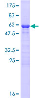 FAM192A / Nip30 Protein - 12.5% SDS-PAGE of human NIP30 stained with Coomassie Blue