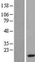 FAM195B Protein - Western validation with an anti-DDK antibody * L: Control HEK293 lysate R: Over-expression lysate