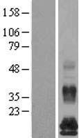 FAM19A5 Protein - Western validation with an anti-DDK antibody * L: Control HEK293 lysate R: Over-expression lysate