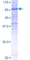 FAM200A Protein - 12.5% SDS-PAGE of human DKFZp727G131 stained with Coomassie Blue