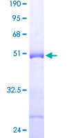 FAM206A / C9orf6 Protein - 12.5% SDS-PAGE of human FLJ20457 stained with Coomassie Blue