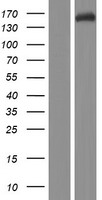 FAM208A Protein - Western validation with an anti-DDK antibody * L: Control HEK293 lysate R: Over-expression lysate