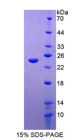 FAM20A Protein - Recombinant Family With Sequence Similarity 20, Member A By SDS-PAGE