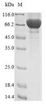 FAM20C Protein - (Tris-Glycine gel) Discontinuous SDS-PAGE (reduced) with 5% enrichment gel and 15% separation gel.