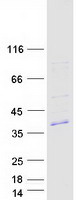 FAM212B Protein - Purified recombinant protein FAM212B was analyzed by SDS-PAGE gel and Coomassie Blue Staining
