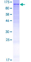 FAM214A Protein - 12.5% SDS-PAGE of human FAM214A stained with Coomassie Blue