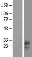 FAM219B / C15orf17 Protein - Western validation with an anti-DDK antibody * L: Control HEK293 lysate R: Over-expression lysate