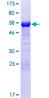 FAM21C Protein - 12.5% SDS-PAGE of human FAM21C stained with Coomassie Blue