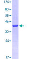 FAM229B / C6orf225 Protein - 12.5% SDS-PAGE of human C6orf225 stained with Coomassie Blue