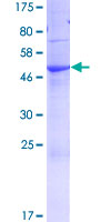 FAM3A Protein - 12.5% SDS-PAGE of human FAM3A stained with Coomassie Blue