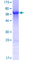 FAM45A Protein - 12.5% SDS-PAGE of human FAM45A stained with Coomassie Blue