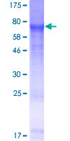 FAM46A Protein - 12.5% SDS-PAGE of human FAM46A stained with Coomassie Blue