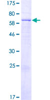 FAM46B Protein - 12.5% SDS-PAGE of human FAM46B stained with Coomassie Blue