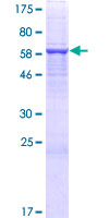 FAM46C Protein - 12.5% SDS-PAGE of human FAM46C stained with Coomassie Blue