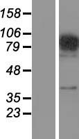 FAM48A / P38IP Protein - Western validation with an anti-DDK antibody * L: Control HEK293 lysate R: Over-expression lysate