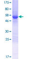 FAM49B / L1 Protein - 12.5% SDS-PAGE of human FAM49B stained with Coomassie Blue
